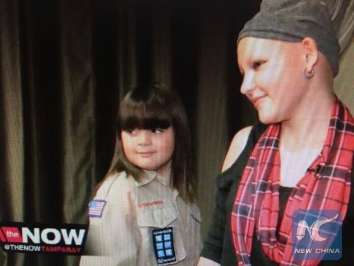 เด็กชายตัวน้อยเลี้ยงผม 2 ปี เพื่อให้เพื่อนที่ผมร่วง