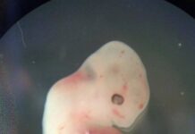 ครั้งแรก! นักวิทย์สร้างเอ็มบริโอมนุษย์-หมู สำหรับปลูกถ่ายอวัยวะได้สำเร็จ
