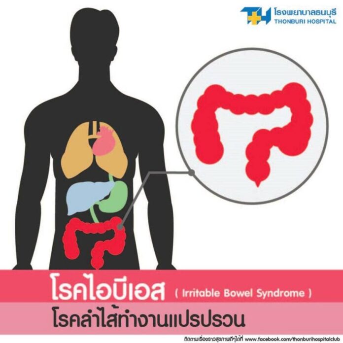 รู้จักโรคไอบีเอส โรคที่คนไทยเป็นกันกว่า 5 ล้านคน