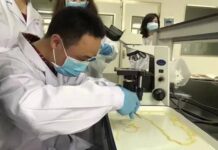 สะพรึง! ชายจีนพบพยาธิ 5 เมตรในร่างกาย หลังกินสเต็กเนื้อกึ่งดิบ